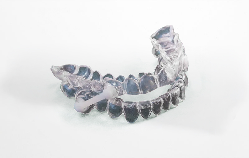 Dispositivo de Avance Mandibular (DAM): Orthoapnea