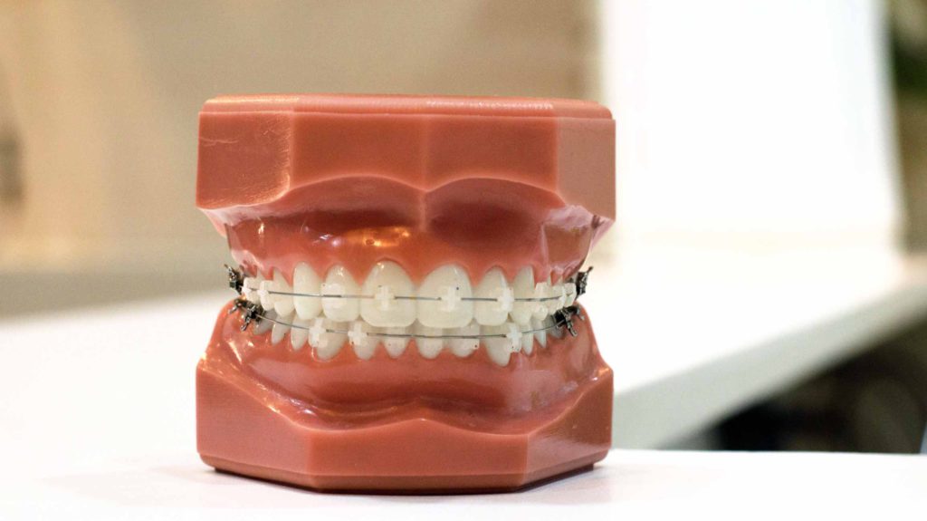 Importancia de la ortodoncia
