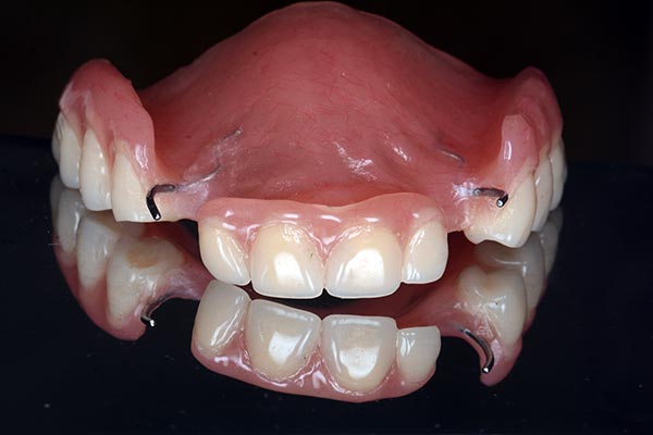 Aplicable Antemano verdad Qué son las prótesis dentales y cuántos tipos existen?