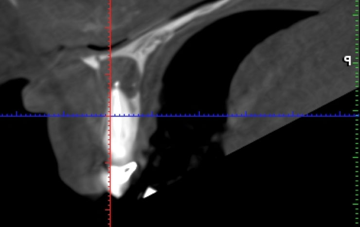 Radiografía periápice 3