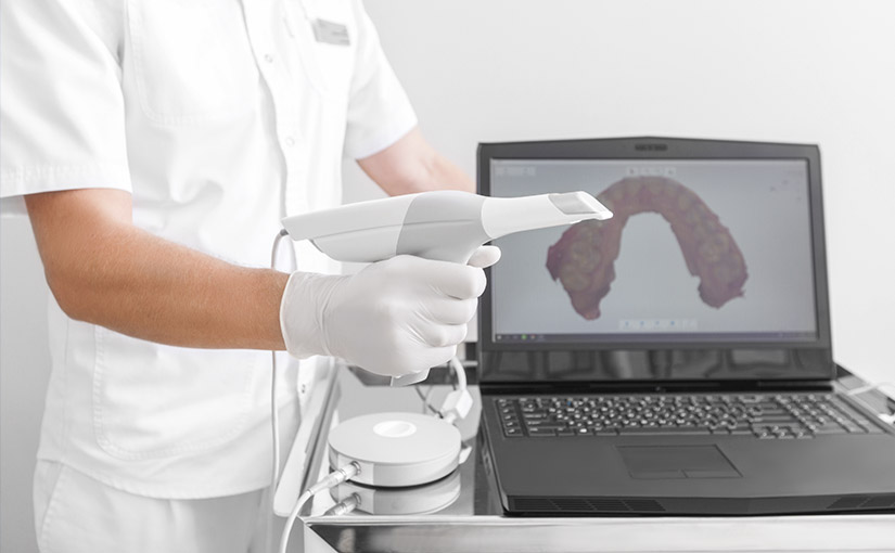 Ventajas del escáner intraoral en tratamientos de ortodoncia
